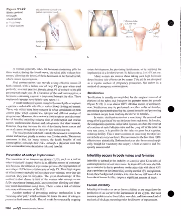 Textbook p. 1150: 51.5 Contraception and Infertility Treatments (Fig 51.22)